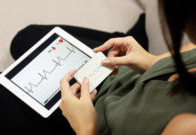 Wiwe elettrocardiogramma iOS e Android
