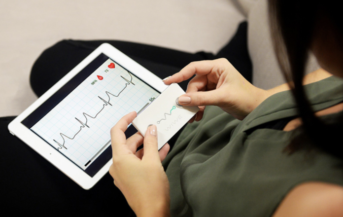 Wiwe elettrocardiogramma iOS e Android